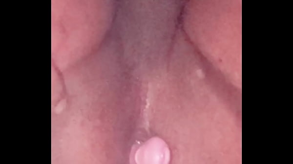 Plug Anal