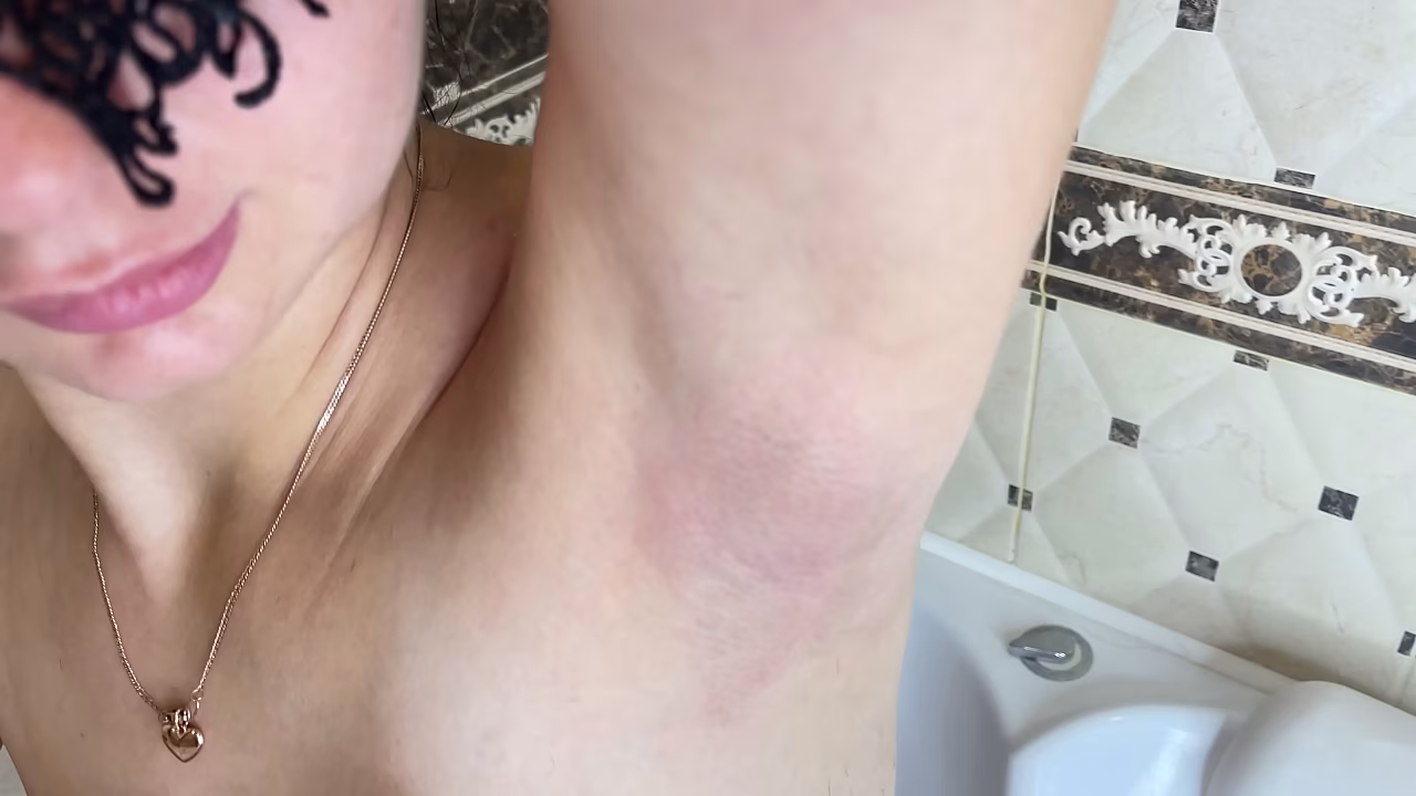 Epilation of hairy armpits with an epilator! Depilation!