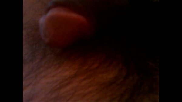 thumb getting hard