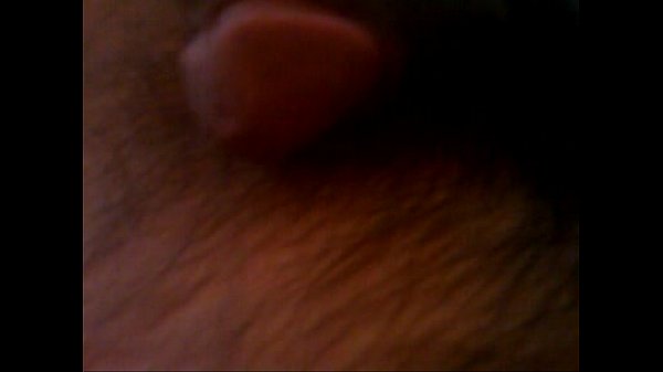 thumb getting hard