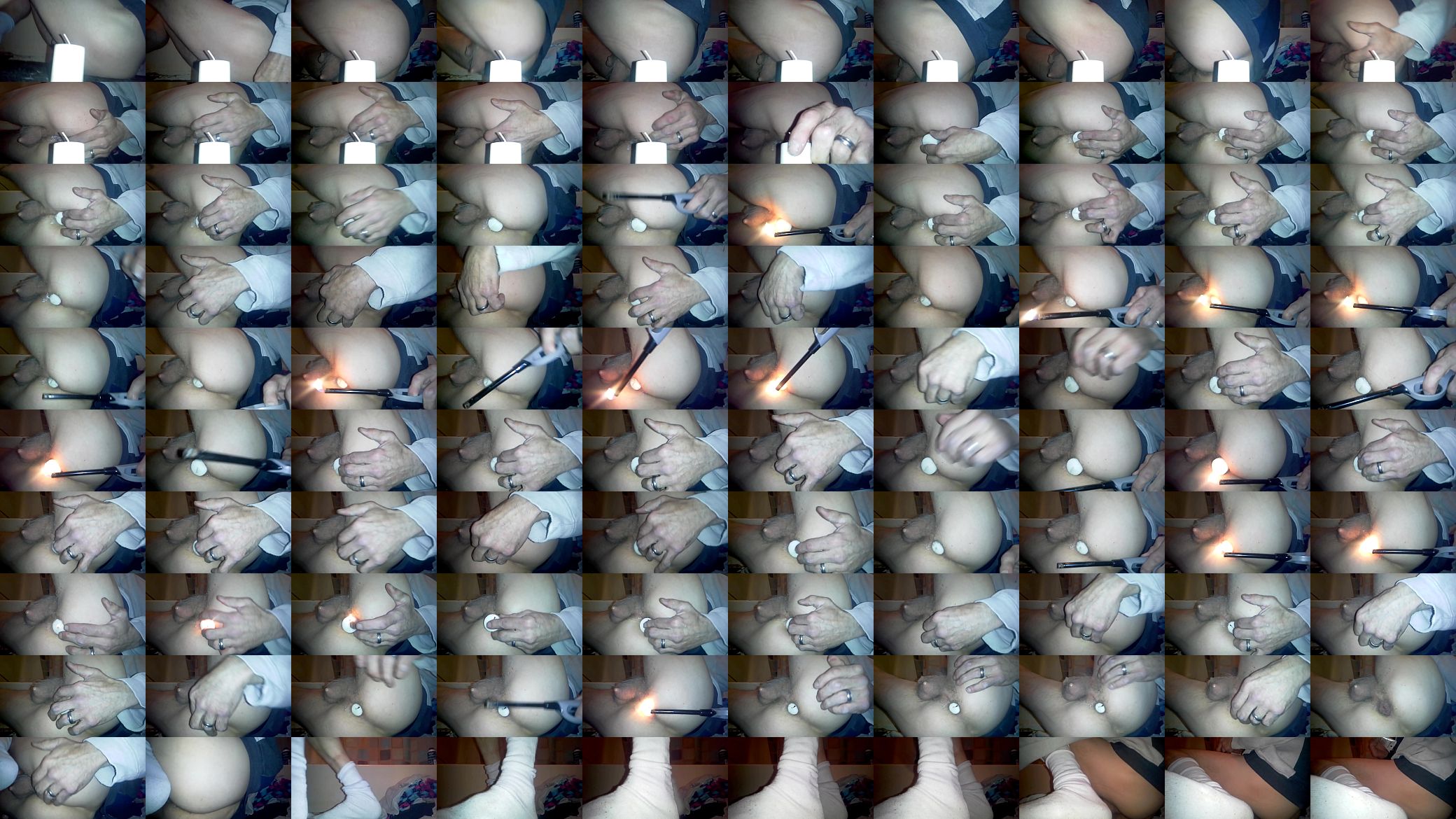Lit candle (and pubes) in gaping hole 预览图