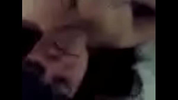 thumb b
