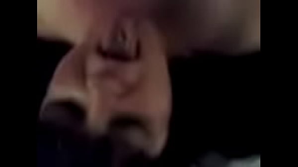 thumb b