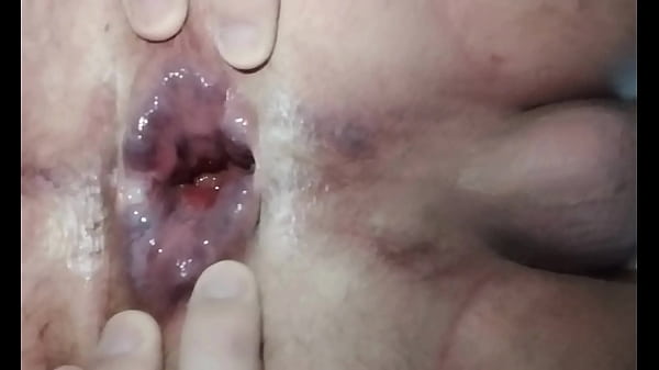 Resultado do cu arrombado pela abobrinha