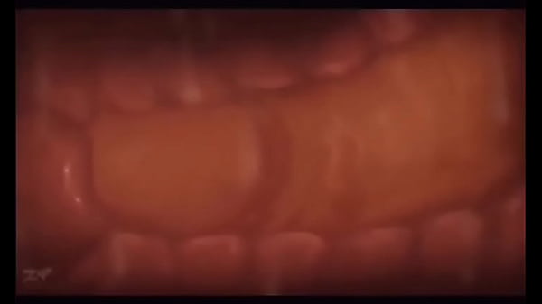 thumb inside