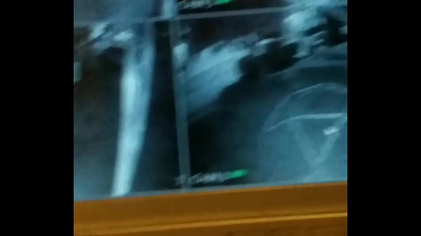 Spy 35 sec