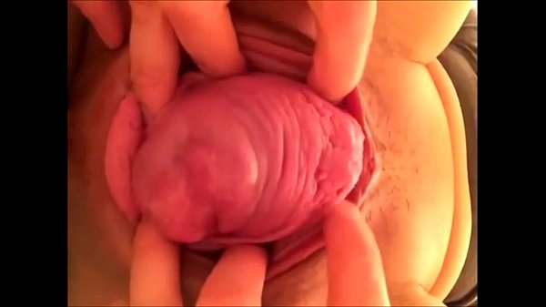 Download Video - japanese prolapse