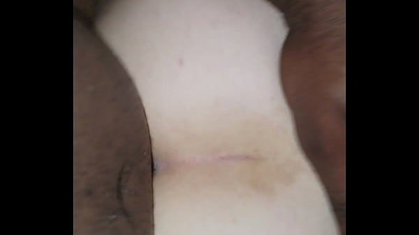 thumb backshots
