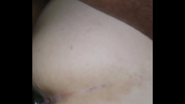 thumb backshots
