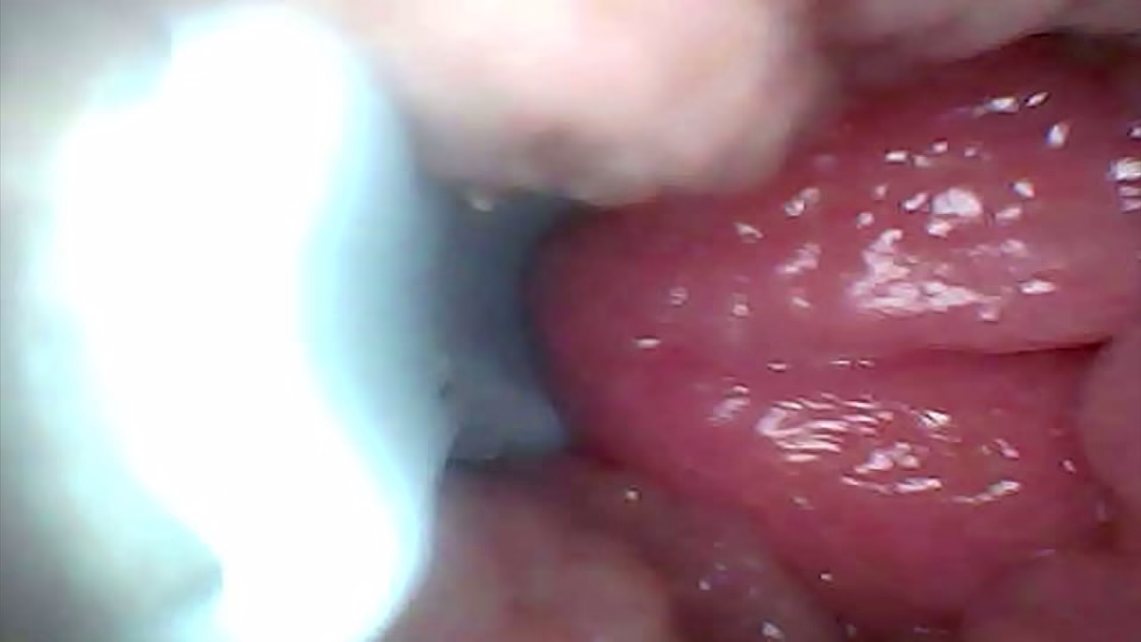 Extreme Proximity Turns Watcher Into Active, Hungry Participant