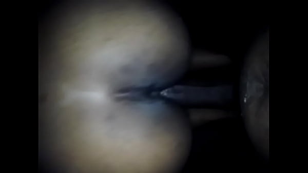 thumb back