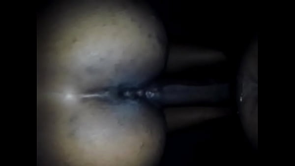 thumb back