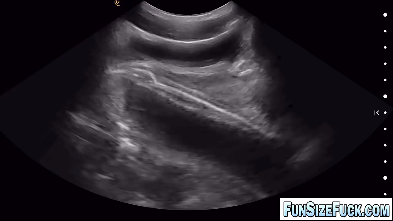 Twink with glasses get his ass destroyed by doctor'_s HUGE dick! Alex Gonz visit doctor Legrand Wolf for a health checkup but can barely walk from the clinic!