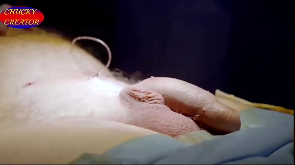 Download Video - My Enlargement Surgery &lpar;Penile Girth and Length Surgery&rpar; for &pound;8495