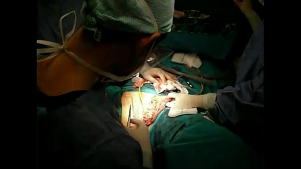 Geschlechtsumwandlungsoperation (Geschlechtsumwandlungsoperation)