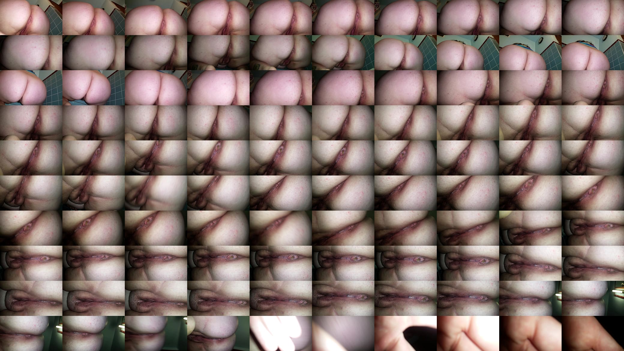 Practicing prolapse 预览图