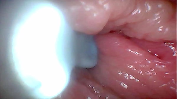 Download Video - First time&colon; An endoscope reveals the G-spot up close &ndash; without mounting&excl;