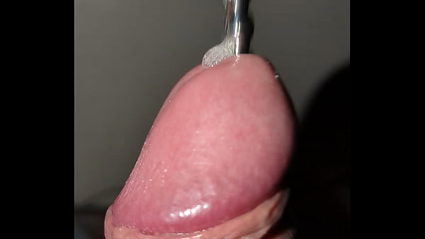 Bulles De Liquide Prostatique
