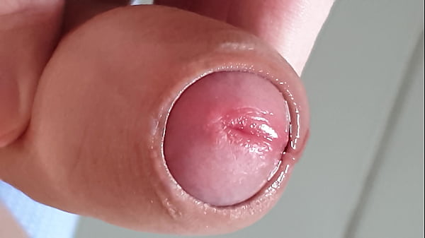 Download Video - 包皮翻開的瞬間