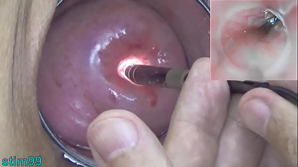 Download Video - Mature Milf Cervix Play with Endoscope Japanese Cam into Uterus