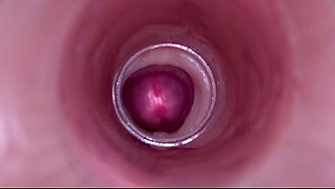Female Insemination - Internal Camera Captures Deep Male Ejaculation