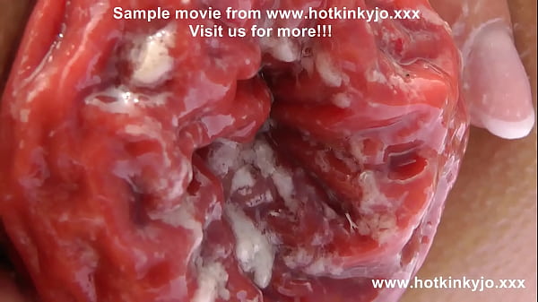 Download Video - Sexy self anal fisting on the beach & prolapse