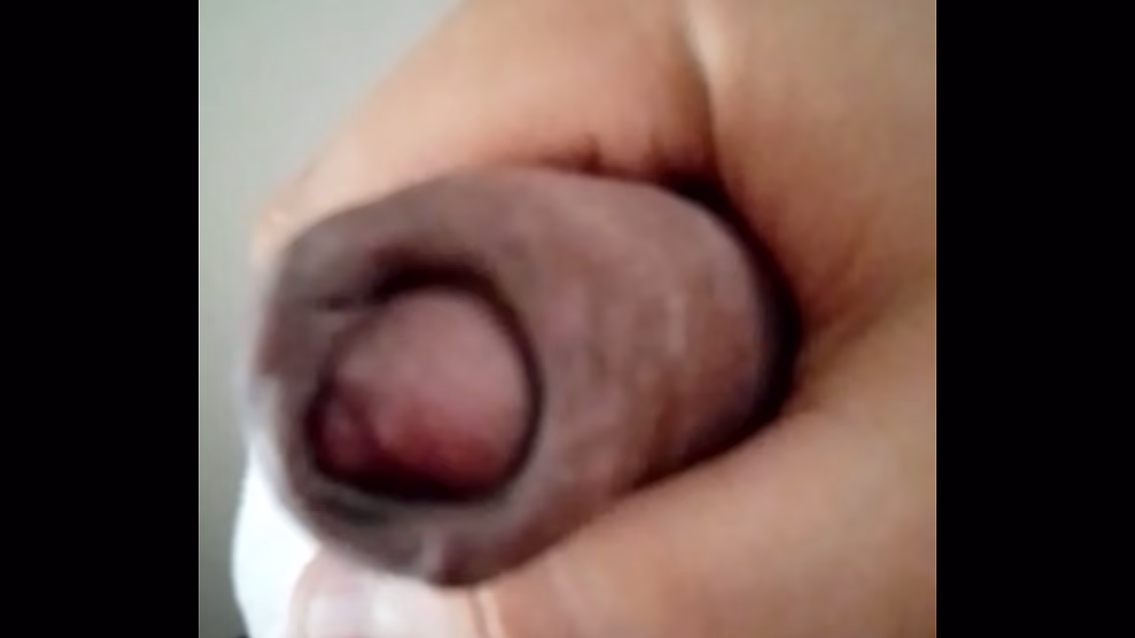 Foreskin. January 7, 2026.
