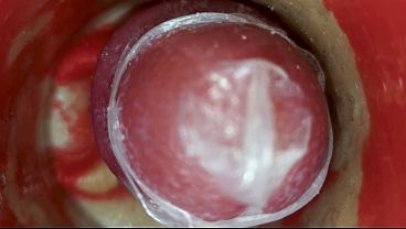 奥深くの膣内のカメラが、コンドームが詰まった状態での大量の射精を記録している