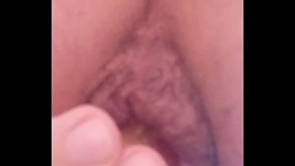 I irritating my hemorrhoidal rose to the point ...