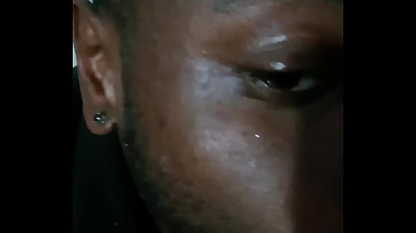 Introducing how my skin also gets sometimes when the weather gets hot and sunny in the summertime while wearing flasher coat to cover the rest of my body from developing too much allergies4