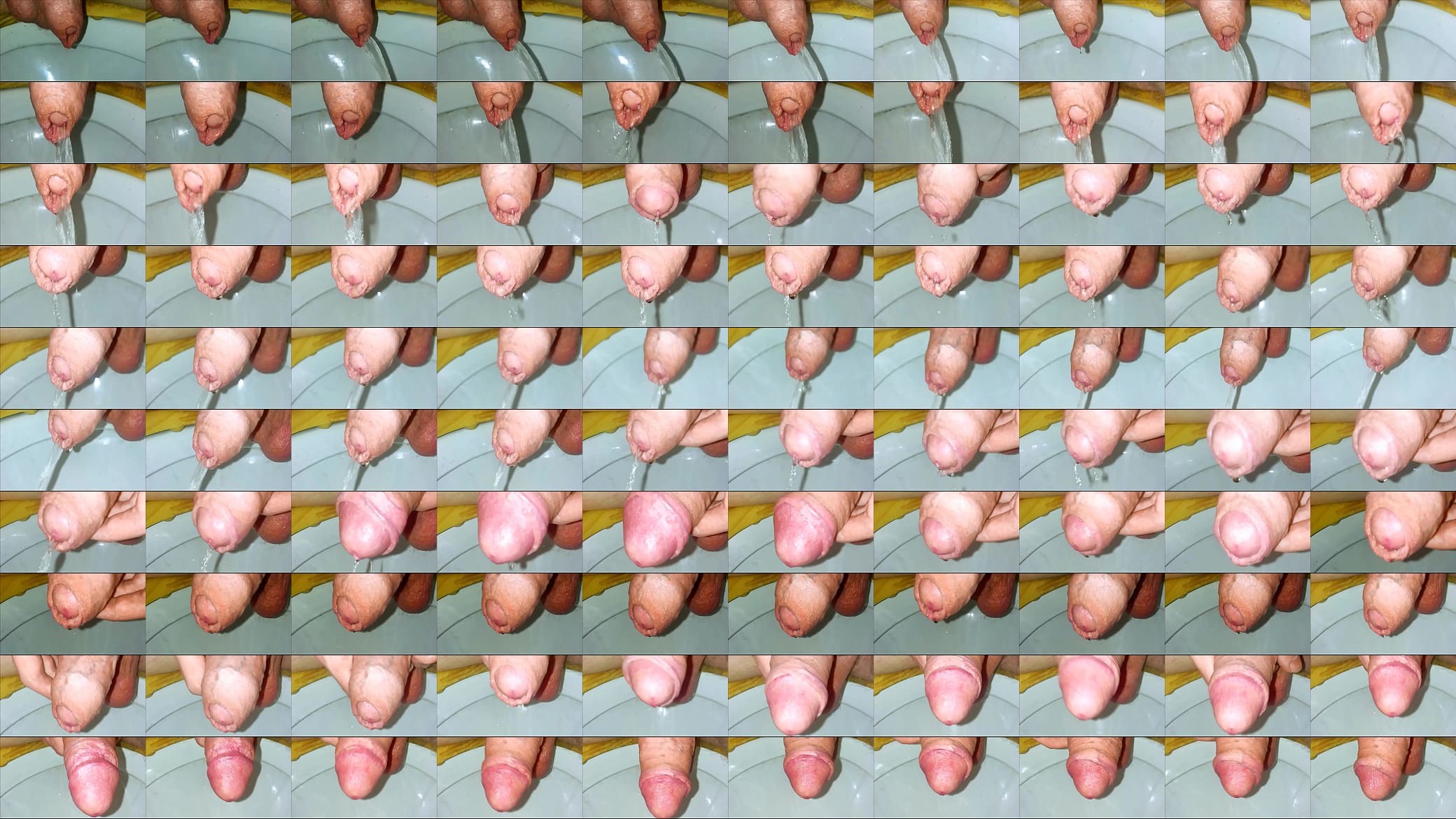 foreskin 预览图