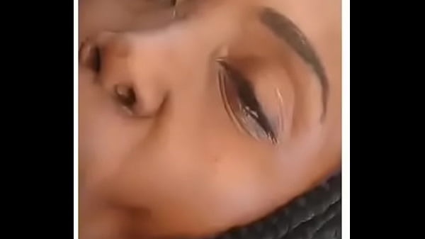 Parking lot head
