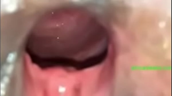 Download Video - VID-20171016-WA0097