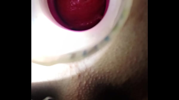 Anal gape and insertion