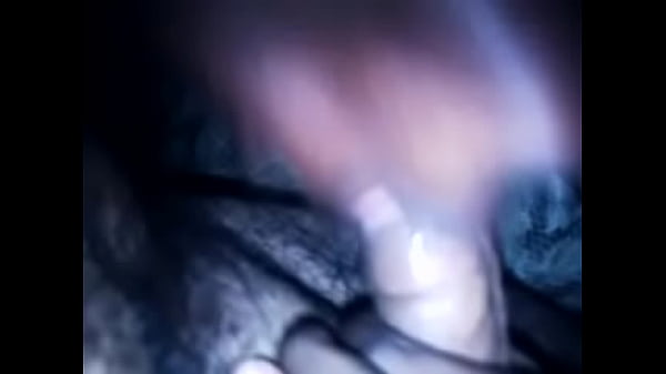 thumb back it up