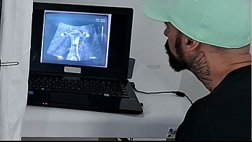 Download Video - Esposa ultrassom penetra&ccedil;&atilde;o corno do lado&excl;