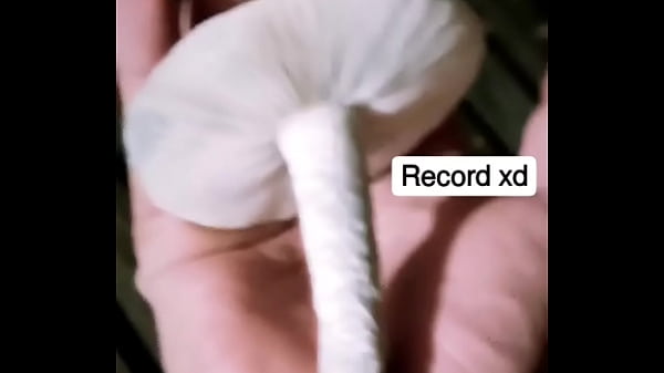 Chileno con callampa del porte de su brazo