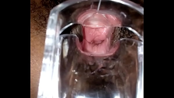SLIM INDIAN BROWN GIRL CERVIX SPECULUM CHECK VAGINAL OPENING
