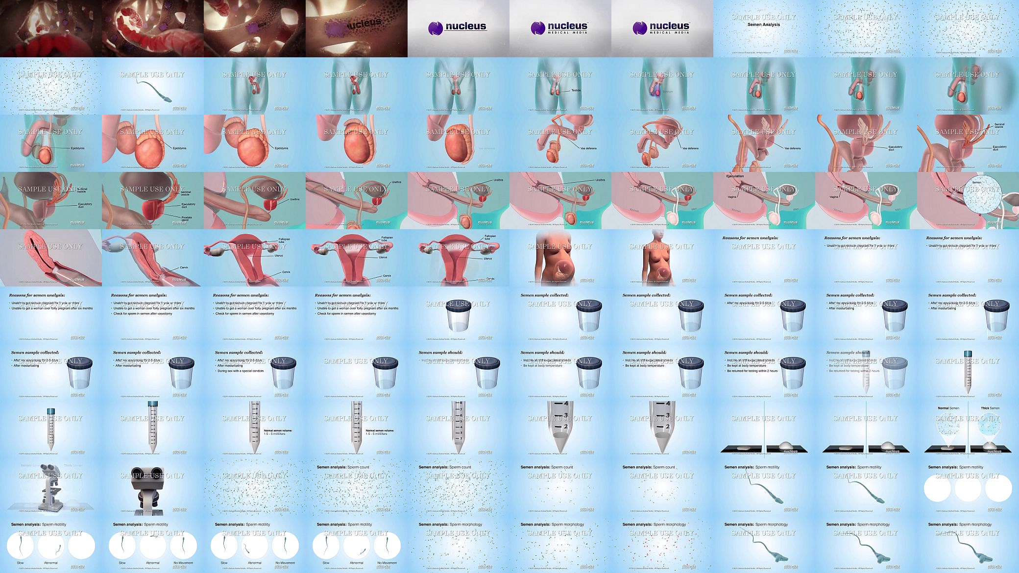 Semen Analysis (Sperm Count) 预览图