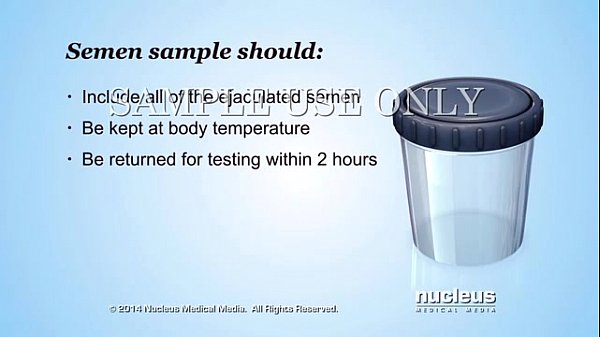 Semen Analysis (sperm Count)