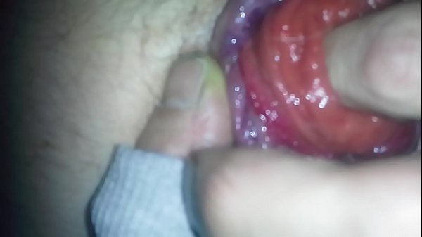 Download Video - anal prolapse
