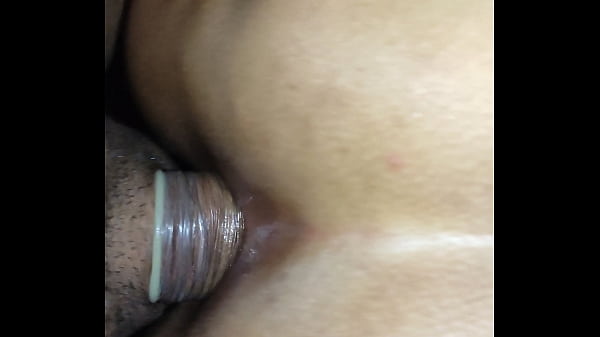 Anal