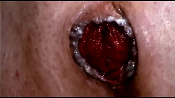 FREE! Urethral Penetration, Double Anal, Deepth...