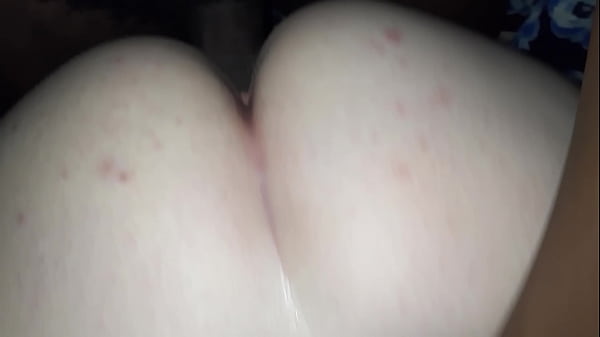 thumb hit it from the back