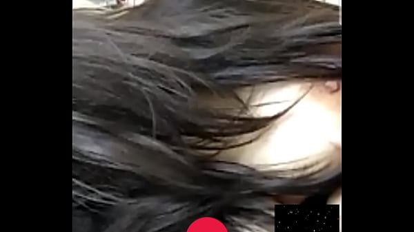 Mamelon Bihari Fille