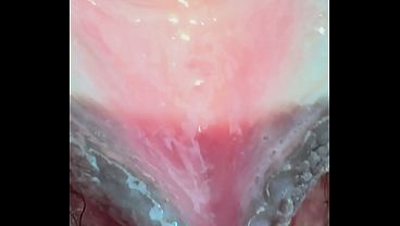 Hairy gape