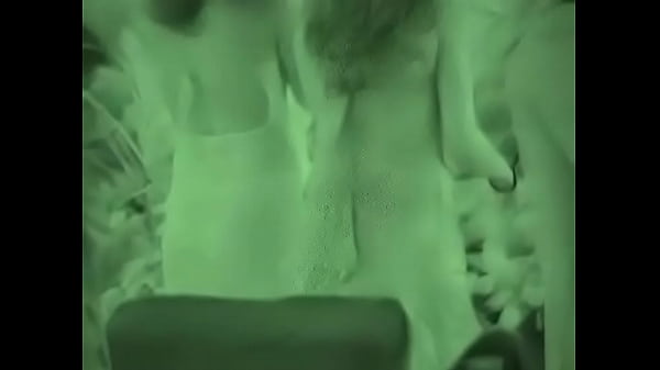 thumb xray wedding