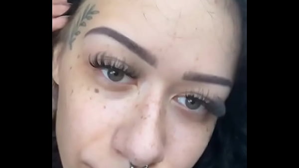 Freckles :)