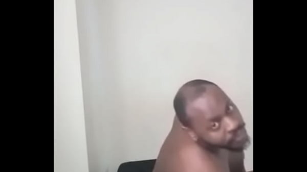 Remembering reasons why I shave my hair a lot and why i don't allow it to grow out too much while returning with bald spot for free 2