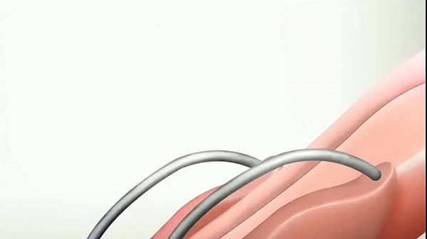 Download Video - V&iacute;deo de verificaci&oacute;n